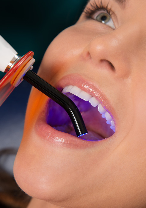 خدمات زیبایی دندان، دندانپزشکی، Dental Beauty